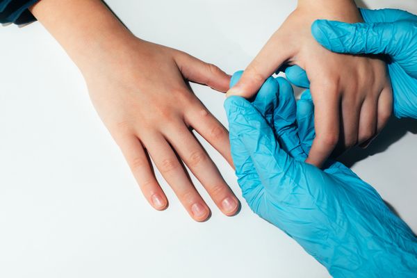 warzen keine chance Haut Warzen Eukalyptusöl