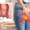 Hilfe bei Hämorrhoiden Hilfe bei Hämorrhoiden