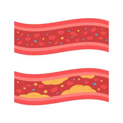 Cholesterin und Blutwerte